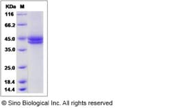 Sino Biological Recombinant Human Factor H-related 1/CFHR1 Protein (His