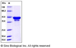Sino Biological Recombinant Human SerpinB6 Protein (His Tag), Quantity: