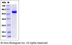 Sino Biological Recombinant Human ALDH4A1 Protein, Quantity: Each of 1