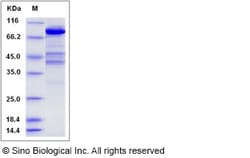 Sino Biological Recombinant Human Ezrin Protein (His Tag), Quantity: Each
