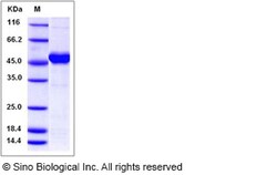 Sino Biological Recombinant Human MAX Protein (His & GST Tag), Quantity:
