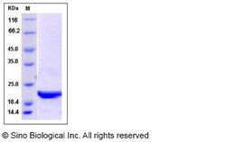 Sino Biological Human UBE2H Protein 100ug, Quantity: Each of 1