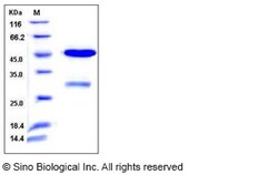 Sino Biological Recombinant Human UNG Protein (GST Tag), Quantity: Each