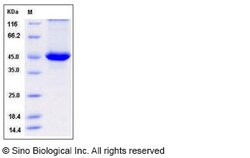 Sino Biological Recombinant Human SERPINB4 Protein (His Tag), Quantity: