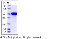 Sino Biological Recombinant Human EBP1 Protein (His Tag), Quantity: Each