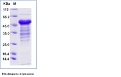 Sino Biological Recombinant Human RTN4 Protein (GST Tag), Quantity: Each