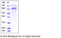 Sino Biological Recombinant Human PDE2A Protein (aa 215-900, His Tag),