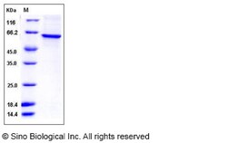 Sino Biological Recombinant Human TRF-1 Protein (His Tag), Quantity: Each