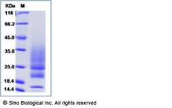 Sino Biological Recombinant Human IL-22 Protein (His Tag), Quantity: Each