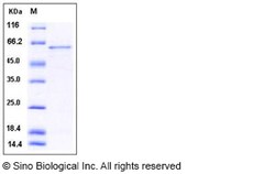 Sino Biological Recombinant Human GOLPH2/GOLM1 Protein (His Tag), Quantity:
