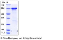 Sino Biological Recombinant Human MTSS1 Protein (aa1-250, His & MBP Tag),