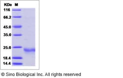 Sino Biological Recombinant Human IL-19 Protein (His Tag), Quantity: Each