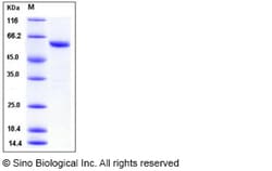 Sino Biological Recombinant Human Thioredoxin reductase 1/TRXR1 Protein