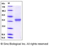 Sino Biological Human IGSF11 / BTIGSF Protein (His Tag) 20ug, Quantity: