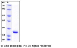 Sino Biological Recombinant Human SUMO1 Protein (His Tag), Quantity: Each