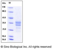 Sino Biological Human IGFBP7 / IBP-7 Protein (His Tag) 50ug, Quantity: