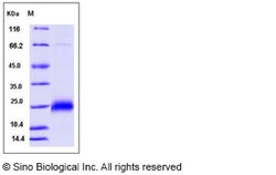 Sino Biological Human CGB7 Protein (His Tag) 100ug, Quantity: Each of 1