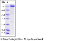 Sino Biological Recombinant Human WWP2 Protein (His & GST Tag), Quantity: