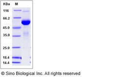 Sino Biological Recombinant Human Mesothelin Protein (hFc Tag), Quantity: