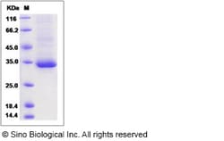 Sino Biological Recombinant Human Mesothelin Protein (His Tag), HPLC-verified,