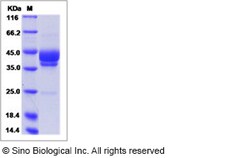Sino Biological Recombinant Human Mesothelin Protein, HPLC-verified, Quantity: