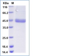 Sino Biological Human Coagulation Factor III / Tissue Factor / CD142 Protein