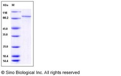 Sino Biological Recombinant Human CaMKI gamma/CAMK1G Protein (His & GST
