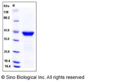 Sino Biological Recombinant Human p53R2 Protein (His Tag), Quantity: Each