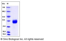 Sino Biological Recombinant Human CCDC134 Protein (His Tag), Quantity: