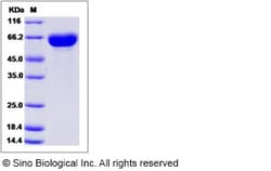 Sino Biological Recombinant Human HEXB Protein (His Tag), Quantity: Each