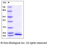 Sino Biological Human TCL1A Protein (His Tag) 100ug, Quantity: Each of