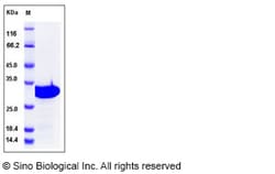 Sino Biological Recombinant Human OTUB2 Protein (His Tag), Quantity: Each
