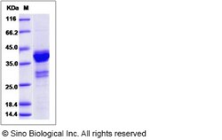 Sino Biological Recombinant Human Ki67/MKI67 Protein (GST Tag), Quantity: