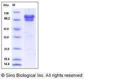 Sino Biological Human NGFR / P75 Protein (Fc Tag) 100ug, Quantity: Each