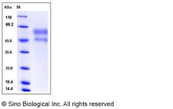 Sino Biological Human NGFR/ P75 Protein (His Tag) 100ug, Quantity: Each