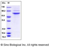 Sino Biological Recombinant Human MST3 Protein (His Tag), Quantity: Each