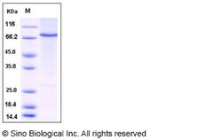 Sino Biological Human STAT4 Protein (His Tag) 50ug, Quantity: Each of 1