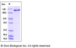 Sino Biological Recombinant Human STAT6 Protein (His Tag), Quantity: Each