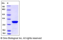 Sino Biological Human PTH / parathyroid hormone Protein (aa 32-65, GST
