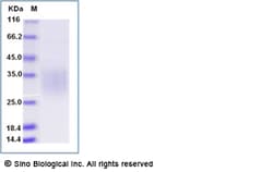 Sino Biological Recombinant Human CD79A Protein (ECD, His Tag), Quantity: