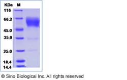 Sino Biological Human CD79A / Ig-alpha Protein (Fc Tag) 100ug, Quantity: