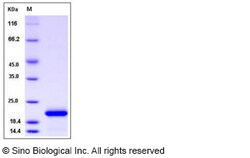 Sino Biological Recombinant Human Ferritin heavy chain 1/FTH1 Protein,