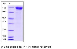Sino Biological Recombinant Human Interferon alpha/beta receptor 1 Protein