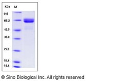 Sino Biological Recombinant Human Alkaline phosphatase/APLI Protein (His