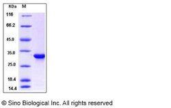 Sino Biological Recombinant Human CYB5R1 Protein (His Tag), Quantity: Each