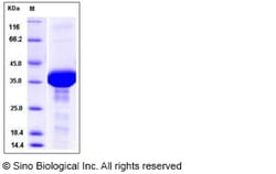 Sino Biological Recombinant Human FDPS Protein (His Tag), Quantity: Each