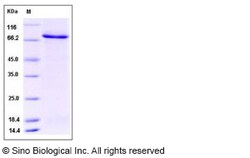Sino Biological Recombinant Human PFKFB3 Protein (His & GST Tag), Quantity:
