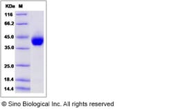 Sino Biological Human Alpha-2-glycoprotein / AZGP1 Protein (His Tag) 100ug,
