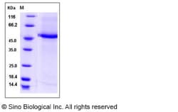 Sino Biological Human CST9L / Testatin Protein (Fc Tag) 100ug, Quantity: