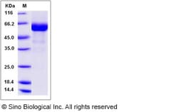Sino Biological Recombinant Human IZUMO4 Protein (hFc Tag), Quantity: Each